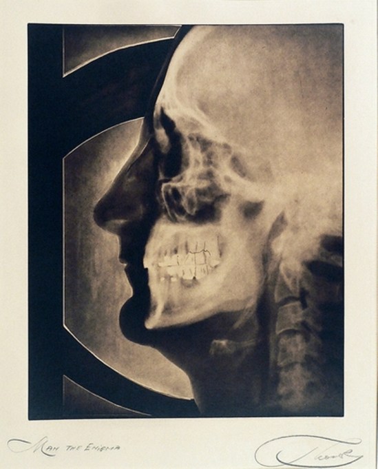 Dr Max Thorek. Man the enigma Via luminouslint