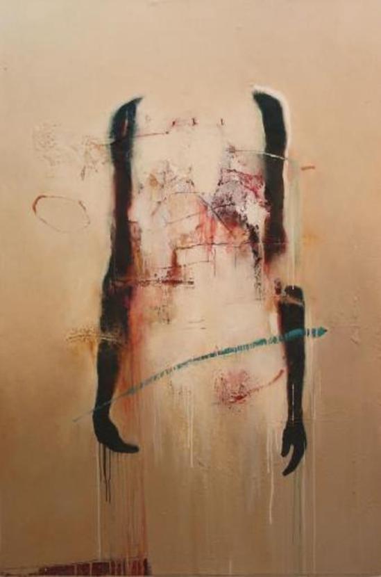 Harry Paul Ally. Two arms