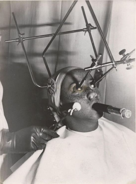 Photographe inconnu. Hungary Electroschock Psychiatry 1930. Via ebay